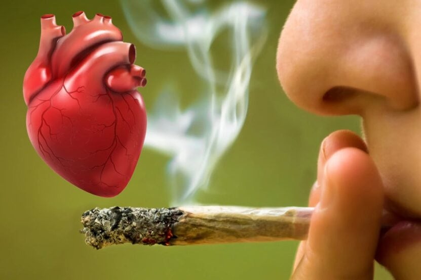 Smoke Is Smoke: Daily Cannabis Use May Increase Heart Attack, Stroke Risks, New Study Finds
